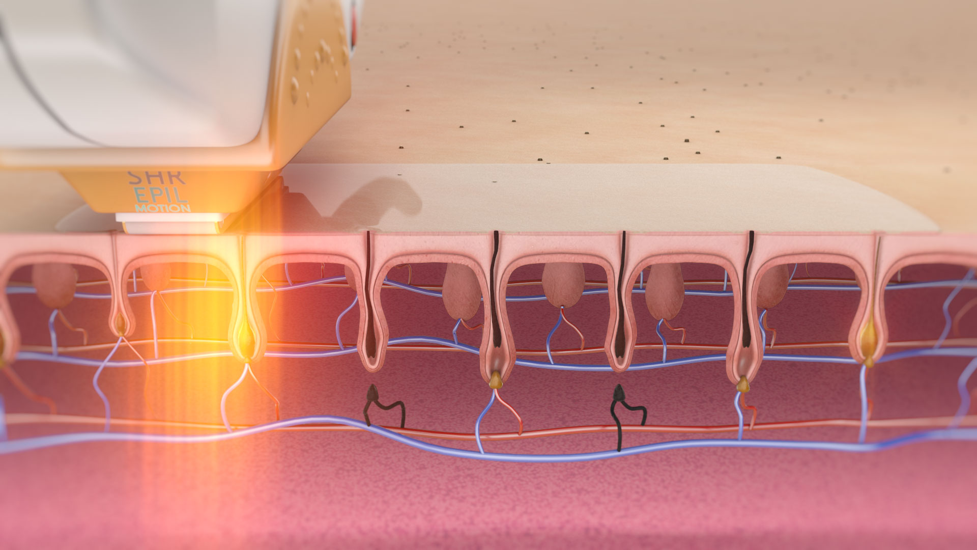 Depilacja Laserowa Animacja 3D