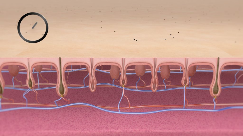 3vo_Depilacja_Laserowa_004 Depilacja Laserowa Animacja 3D