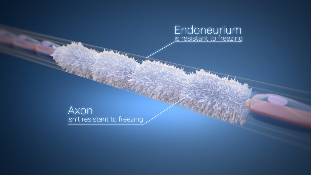 Animacja 3d medyczna odbudowa nerwu 3vo Studio 02 Animacja 3d medyczna odbudowa nerwu 3vo Studio 02