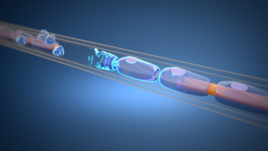 Animacja 3d medyczna odbudowa nerwu 3vo Studio 04 Animacja 3d medyczna odbudowa nerwu 3vo Studio 04