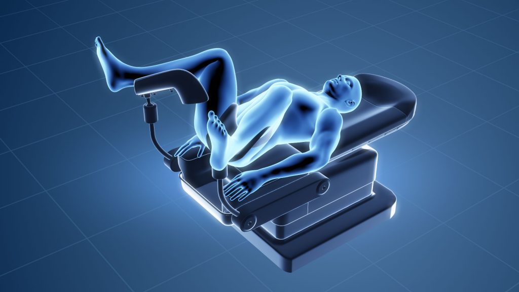 Animacja 3D Hemoroidy 001 Animacja 3D Hemoroidy 001