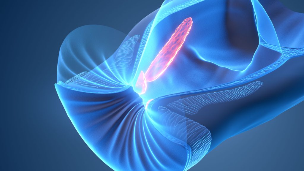 Animacja 3D Hemoroidy 006 Animacja 3D Hemoroidy