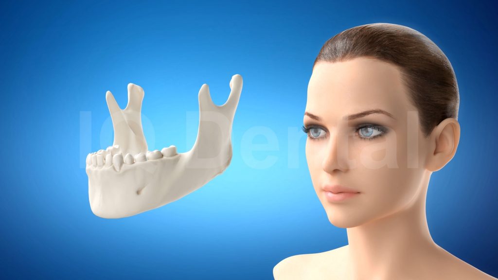 3vo Dentystyczne Animacje 3D 006 3vo Dentystyczne Animacje 3D