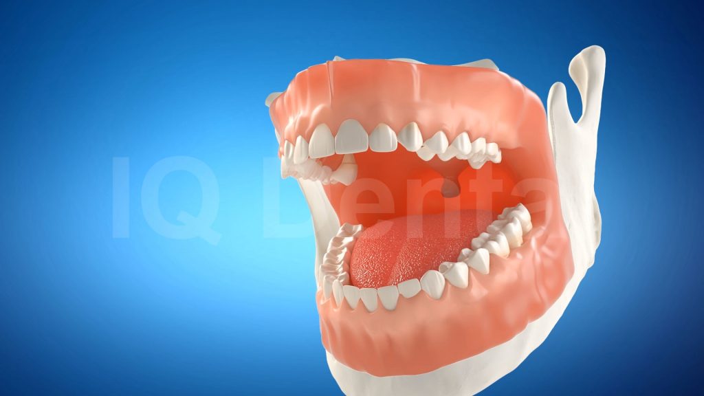3vo Dentystyczne Animacje 3D 007 3vo Dentystyczne Animacje 3D