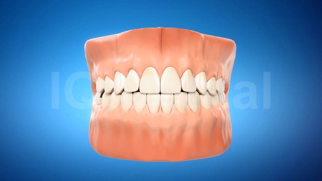 3vo Dentystyczne Animacje 3D 008 3vo Dentystyczne Animacje 3D