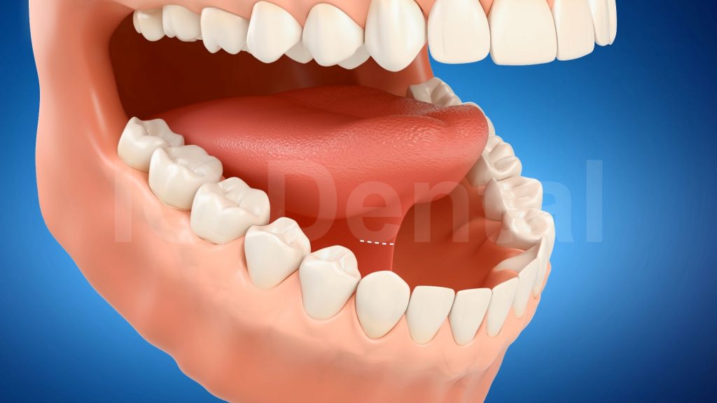 3vo Dentystyczne Animacje 3D 009 3vo Dentystyczne Animacje 3D