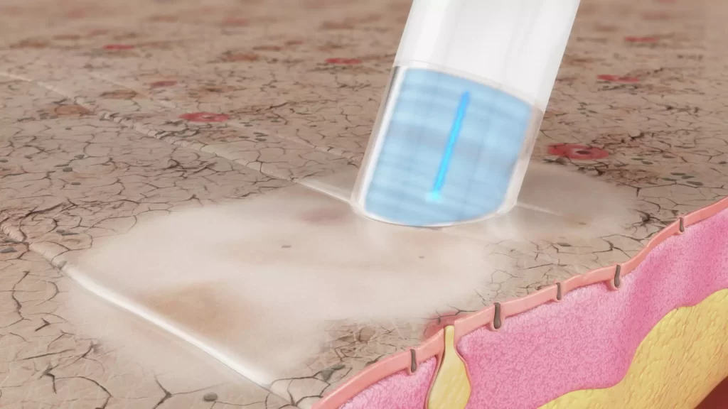 Animacja medyczna 3D Hydroimpact 004 Animacja medyczna 3D Hydroimpact