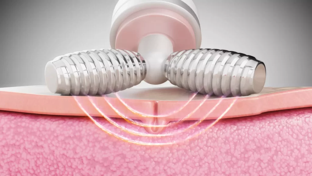 Animacja medyczna 3D Hydroimpact 006 Animacja medyczna 3D Hydroimpact